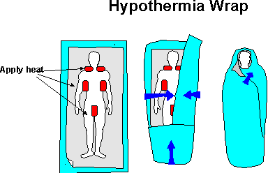 Hypothermia wrap